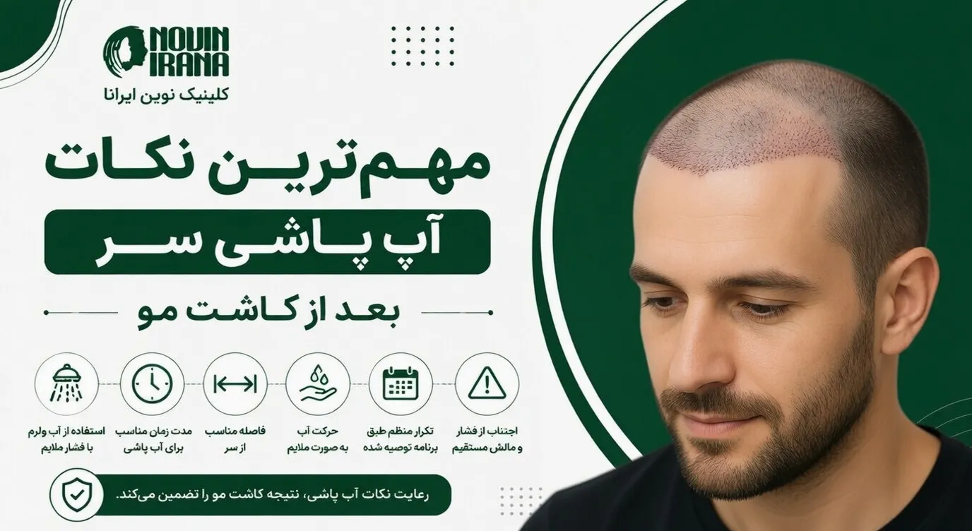 مهم ترین نکات آب پاشی سر